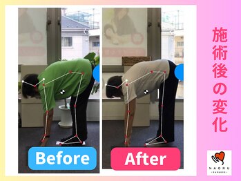 ナオル整体 川越院(NAORU整体)/膝が伸びるように【整体/矯正】