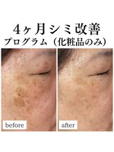 フェリス(FELIZ)/お化粧品だけで変わる！？