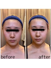 ドクタージェーナ(Dr.Jena)/お客様before/after