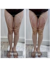 ウィズ ユー ビューティ(with U beauty)/1度でこんなに！