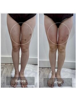 ウィズ ユー ビューティ(with U beauty)/1度でこんなに!