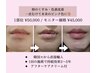 韓国最新美容！唇のくすみ・メラニン除去  50,000円→45,000円
