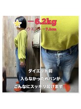 スマイル アップ/履けなかったジーパンがするっと