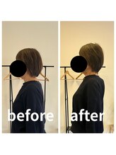 熊本カワル整体 JR上熊本駅院/ストレートネック