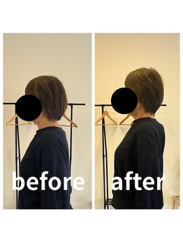 熊本カワル整体 JR上熊本駅院/ストレートネック