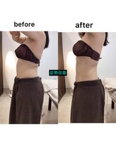 ジョワイユ(Joyeux)/腸の位置でお腹は変わる