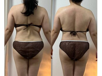 リュミエール(Lumiere)/変わらない身体はない！！