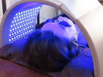 タピヨン 渋谷鍼療院(Tapiyon)/【ウォーターカラー】引き締め