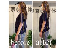 猫背・巻き肩・反り腰・骨盤の歪みを短期間で改善する整体◎