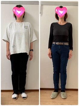 リノリコ 千葉船橋(Lino Liko)の写真/【船橋駅徒歩5分★】耳つぼ¥1500/リフトアップ耳つぼジュエリー¥3980　あなたに合った施術をご提案♪