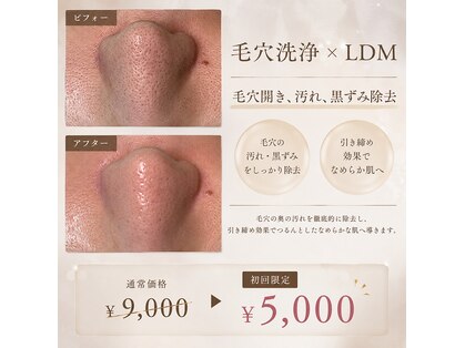 ベルエス(bell.s)の写真