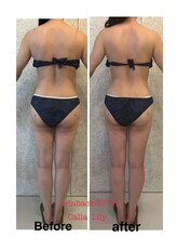 カラーリリー(Calla Lily)/太ももの太さがお悩み（初回）