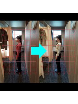 きぼう鍼灸整骨院/猫背解消