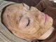 リラビューティー(Lilas Beauty)の写真/大人気☆幹細胞エクソハーブピーリングでゴワつき肌を一掃！ハリ・ツヤ・美白を速攻実感◎