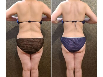 ワンルーム(1ROOM)/3ヶ月のビフォーアフター