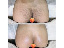 ナチュラヒルズ(Naturahills)/