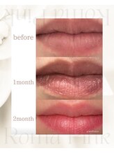 スリーメイ(3mey)/【ローマピンク】リップ症例
