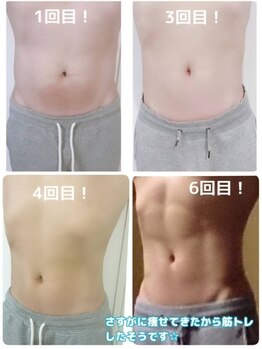 ルアナ(Luana)/今、話題の脂肪冷却ダイエット♪