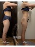★3ヶ月で短期ダイエット★産後太り解消！たるみ太腿の凸凹ゼロ理想ボディへ