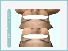 スリムライン 弘前店(The Slim Line)/before→after