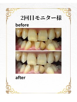 ホワイトニングショップ 葵区静岡駅店/ホワイトニング店ホワイトニング