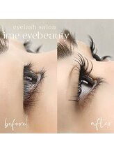 アイミーアイビューティー 宇都宮江曽島店(ime eyebeauty)/二重効果