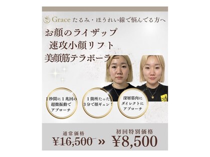 グレイス(Grace)の写真