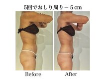 ナチュラーレ 天王寺店(Naturale)/痩身リンパマッサージ二の腕美脚