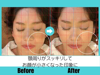 サロンドエルサ(Salon de ELSA)の写真/【男性整体師オールハンド施術】老化によって変形した骨格を整え若かりし頃の整った小顔へ◎