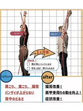 ナオル整体 山形天童院(NAORU整体)/【肩こり解消】上がりずらさも◎