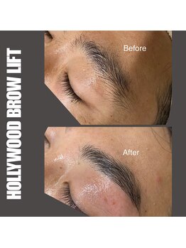 セラス(CERAS)/ハリウッドブロウリフト