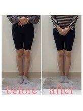 スタイルラボ高松/産後骨盤矯正の効果♪