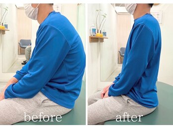 大川カイロプラクティックセンター 国立整体院/頭痛×猫背矯正 / BeforeAfter