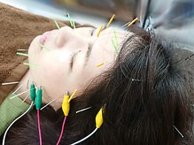 ケヤキ(KEYAKI)の雰囲気（電気を流す美容鍼で筋肉を運効率的に動かしリフトアップの期待◎）