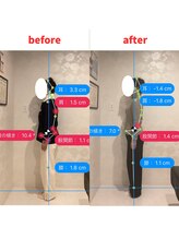 ナオル整体 福岡香椎院(NAORU整体)/60代女性施術事例【姿勢改善】