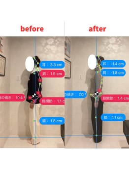 ナオル整体 福岡香椎院(NAORU整体)/60代女性施術事例【姿勢改善】