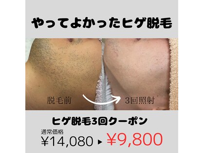 モルト(MOLT)の写真