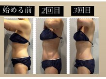 ラヴィエール(Laviere)/【レディース痩身】120分