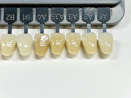 ビア(VIA)の写真