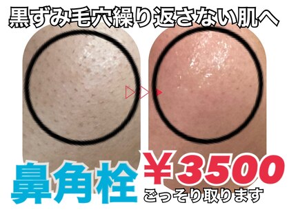 マルサンカクシカク(○△□)の写真