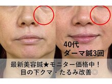 皇漢堂鍼灸療院の雰囲気（目のクマ・たるみ★最新美容鍼【ダーマ鍼】8/31まで特別価格）