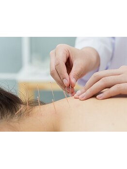 鍼灸施術を受けたい