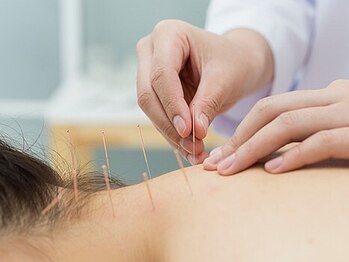 ネーム鍼灸整骨院 春日 本郷三丁目院の写真/鍼灸で整える、自律神経と身体のバランスを。肩こり・腰痛・自律神経の乱れを鍼灸で根本改善!