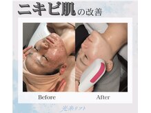 美と健康と痩身サロン マリアローズ(Maria Rose)/肌の土台から変わる最新美容