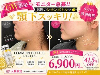 ピュアリー(purly)の写真/レモンボトル6900円！凄レモンボトルで速攻小顔爆誕体験♪顎下のたるみ.二重アゴ速攻ケアでスッキリ小顔に
