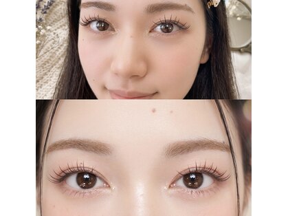 グランツ フリル アイ ビューティ 谷山店(GLANZ Frill Eye Beauty)の写真