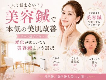 オン 蕨駅西口(ON)の写真/リフトアップしたい小顔に◎乾燥やくまもケア！美容鍼＆インディバで理想のフェイスラインへ♪