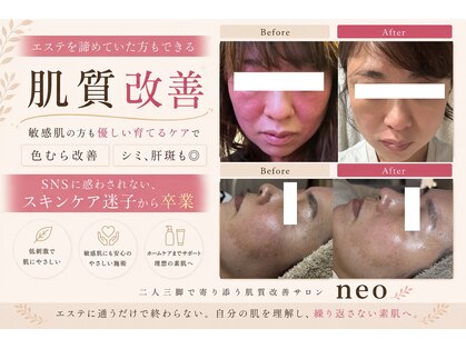 ネオ 熊本玉名(neo)の写真