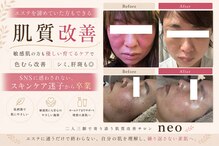 ネオ 熊本玉名(neo)