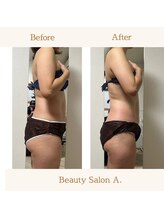 エードット 銀座(A.)/before　→　after